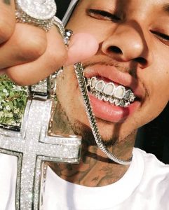 Para dientes brillantes los del rapero Tyga.