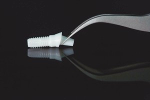 Desde el CINN se trabaja en la fabricación de una nueva generación de implantes.