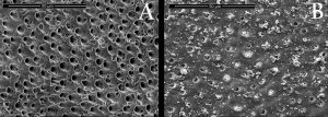Imagen de microscopio electrónico de barrido (MEB), en la que se observa la dentina expuesta tras el ataque del ácido cítrico, en situación de máxima hipersensibilidad (Parte A); y la dentina después del tratamiento con fitoesfingosina, donde el fosfato dicálcico ocluye de forma eficaz los túbulos de la dentina, reduciendo su permeabilidad y, con ello, la sensibilidad de los dientes después de un ataque ácido (Parte B).