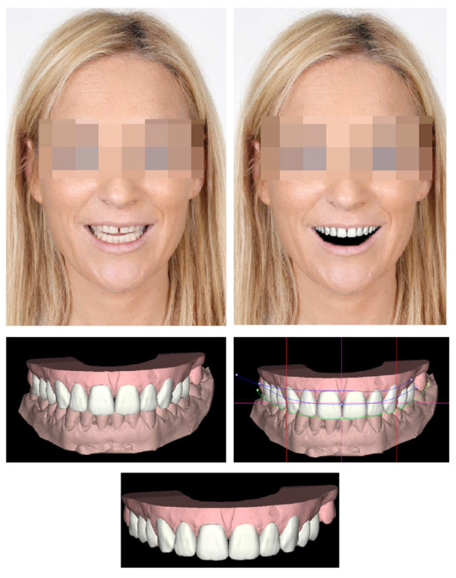 Diseño digital de la Sonrisa